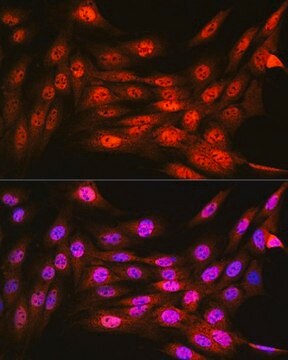 Anti-VCP antibody produced in rabbit