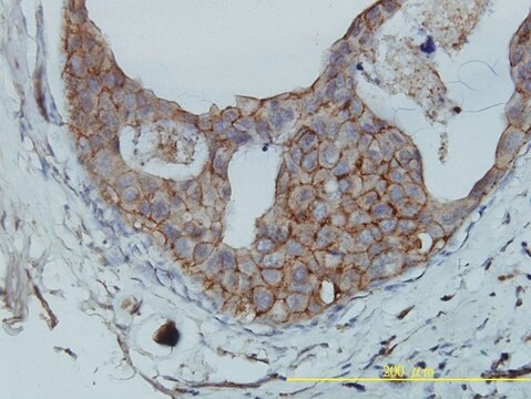 Monoclonal Anti-F11R antibody produced in mouse clone 2E3-1C8, purified immunoglobulin, buffered aqueous solution