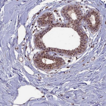 Anti-BRCA1 antibody produced in rabbit Prestige Antibodies&#174; Powered by Atlas Antibodies, affinity isolated antibody, buffered aqueous glycerol solution