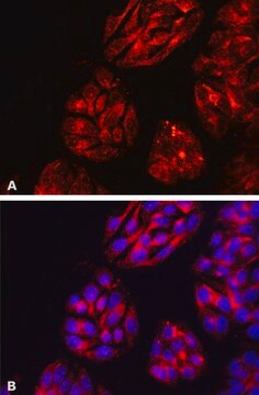 Anti-DPP4/CD26 antibody, Mouse monoclonal clone A6H, purified from hybridoma cell culture