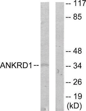 Anti-ANKRD1 antibody produced in rabbit affinity isolated antibody