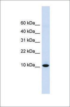 Anti-DDT antibody produced in rabbit affinity isolated antibody