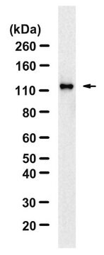 Anti-phospho-ULK1-Ser757 Antibody, clone 5L18 ZooMAb&#174; Rabbit Monoclonal recombinant, expressed in HEK 293 cells