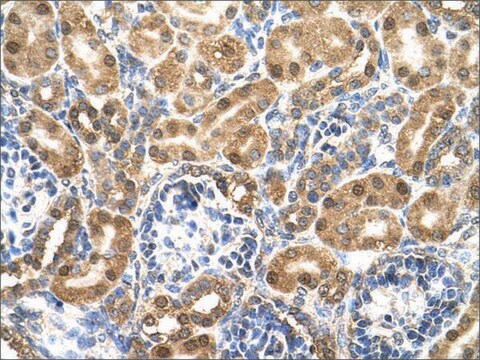 Anti-ENO3 (AB1) antibody produced in rabbit affinity isolated antibody