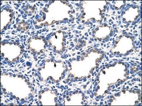 Anti-EMP2 antibody produced in rabbit IgG fraction of antiserum