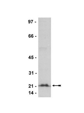 Anti-Rho (-A, -B, -C) Antibody, clone 3L74, rabbit monoclonal clone 3L74, Upstate&#174;, from rabbit