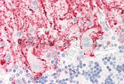 Anti-RCAN1 (N-terminal) antibody produced in rabbit affinity isolated antibody