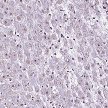 Anti-ATMIN antibody produced in rabbit Prestige Antibodies&#174; Powered by Atlas Antibodies, affinity isolated antibody, buffered aqueous glycerol solution