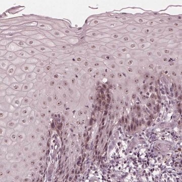 Anti-SLX4 antibody produced in rabbit Prestige Antibodies&#174; Powered by Atlas Antibodies, affinity isolated antibody, buffered aqueous glycerol solution