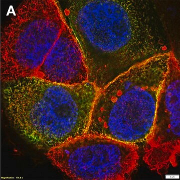 Anti-CFTR Antibody, clone MM13-4 ZooMAb&#174; Mouse Monoclonal recombinant, expressed in HEK 293 cells