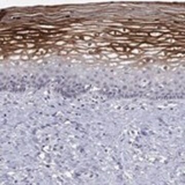 Anti-ALOX12 antibody produced in rabbit Prestige Antibodies&#174; Powered by Atlas Antibodies, affinity isolated antibody, buffered aqueous glycerol solution