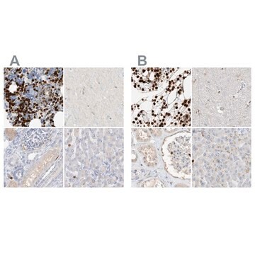 Anti-GCA antibody produced in rabbit Prestige Antibodies&#174; Powered by Atlas Antibodies, affinity isolated antibody, buffered aqueous glycerol solution