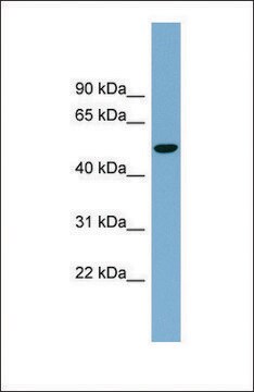 Anti-SLC2A8 antibody produced in rabbit affinity isolated antibody