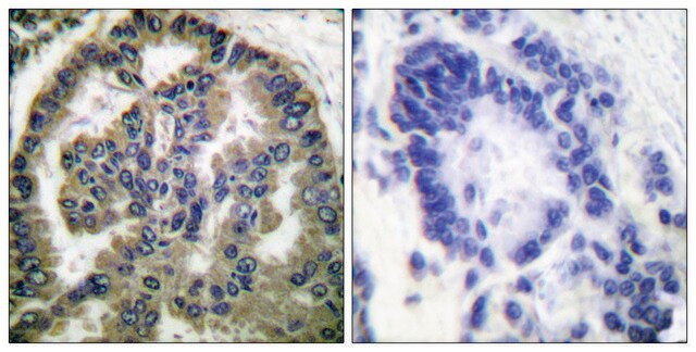 Anti-TGF &#946;2, C-Terminal antibody produced in rabbit affinity isolated antibody