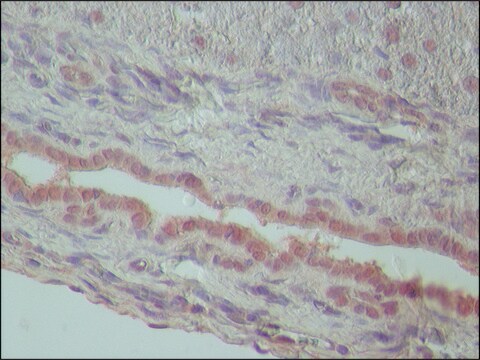 Anti-TDP-43 antibody produced in rabbit ~1.5&#160;mg/mL, affinity isolated antibody, buffered aqueous solution