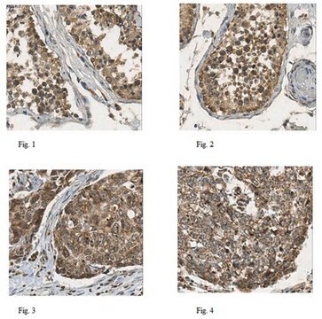 Anti-DHODH Antibody from rabbit, purified by affinity chromatography