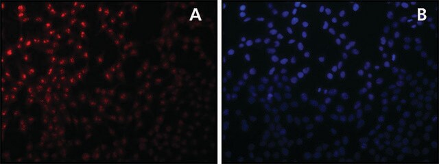 Anti-Sirt7 antibody produced in rabbit affinity isolated antibody, buffered aqueous solution