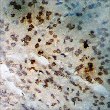 Anti-phospho-BTK (pTyr223) antibody produced in rabbit affinity isolated antibody