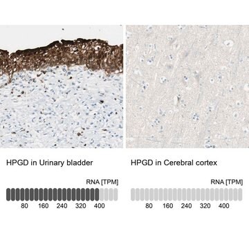 Anti-HPGD antibody produced in rabbit Ab1, Prestige Antibodies&#174; Powered by Atlas Antibodies, affinity isolated antibody, buffered aqueous glycerol solution