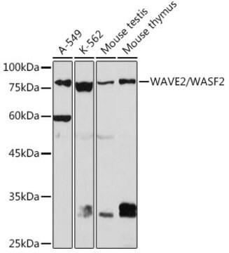 Anti-WAVE2/WASF2 Antibody, clone 7A6C10, Rabbit Monoclonal