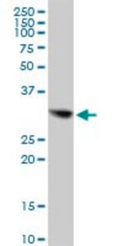 Anti-CBR1 antibody produced in mouse purified immunoglobulin, buffered aqueous solution