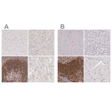 Anti-ARHGAP4 antibody produced in rabbit Ab2, Prestige Antibodies&#174; Powered by Atlas Antibodies, affinity isolated antibody, buffered aqueous glycerol solution