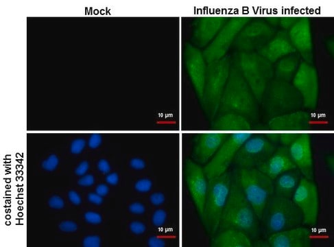 Monoclonal Anti-Influenza B Virus NP antibody produced in mouse clone GT371, affinity isolated antibody