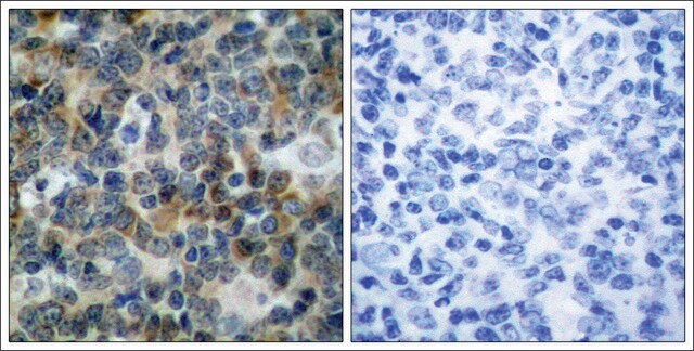 Anti-phospho-VASP (pSer239) antibody produced in rabbit affinity isolated antibody