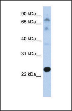 Anti-CHIC2, (N-terminal) antibody produced in rabbit affinity isolated antibody