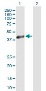 Anti-HSD11B2 antibody produced in mouse purified immunoglobulin, buffered aqueous solution