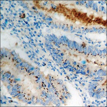 Anti-phospho-Cortactin (pTyr466) antibody produced in rabbit affinity isolated antibody