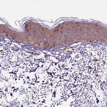 Anti-HDAC5 antibody produced in rabbit Prestige Antibodies&#174; Powered by Atlas Antibodies, affinity isolated antibody, buffered aqueous glycerol solution