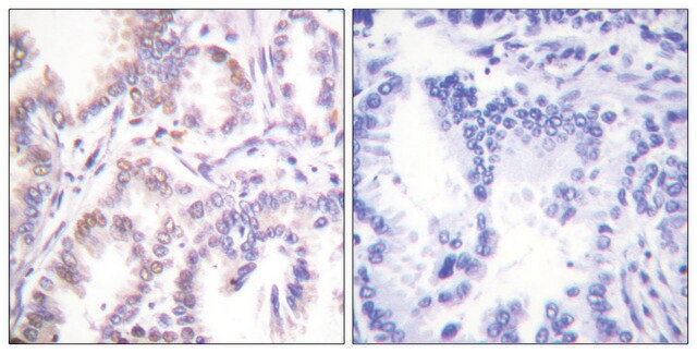 Anti-CDK7 antibody produced in rabbit affinity isolated antibody