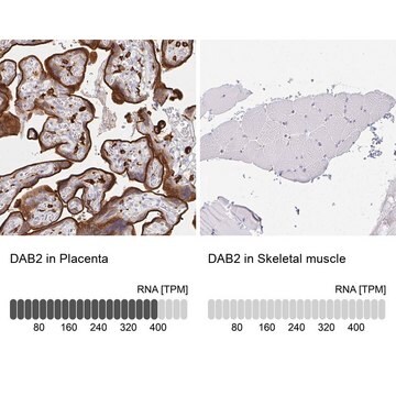 Anti-DAB2 antibody produced in rabbit Prestige Antibodies&#174; Powered by Atlas Antibodies, affinity isolated antibody, buffered aqueous glycerol solution