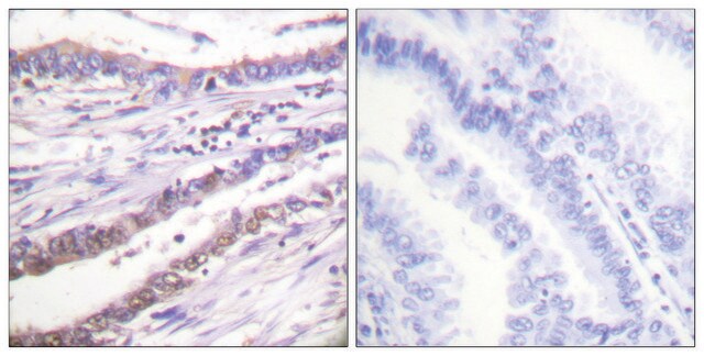 Anti-Cyclin A antibody produced in rabbit affinity isolated antibody