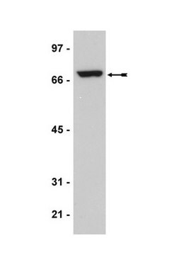 Anti-p68 Antibody, clone204 clone 204, Upstate&#174;, from mouse