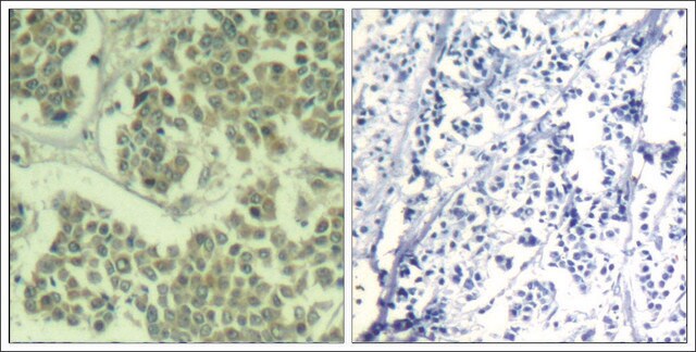 Anti-phospho-EIF2S1 (pSer49) antibody produced in rabbit affinity isolated antibody