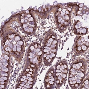 Anti-EMILIN3 antibody produced in rabbit Prestige Antibodies&#174; Powered by Atlas Antibodies, affinity isolated antibody, buffered aqueous glycerol solution