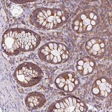 Anti-GFPT2 antibody produced in rabbit Prestige Antibodies&#174; Powered by Atlas Antibodies, affinity isolated antibody, buffered aqueous glycerol solution