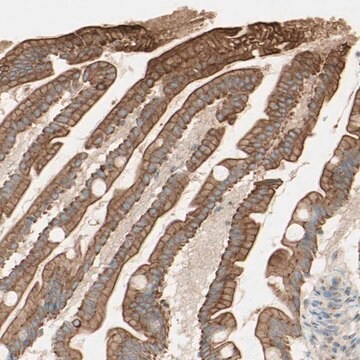 Anti-MTM1 antibody produced in rabbit Ab2, Prestige Antibodies&#174; Powered by Atlas Antibodies, affinity isolated antibody, buffered aqueous glycerol solution