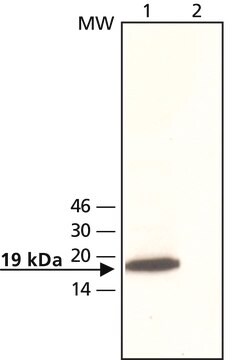 Anti-OMP antibody produced in rabbit ~2&#160;mg/mL, affinity isolated antibody, buffered aqueous solution