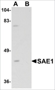 Anti-SAE1 antibody produced in rabbit affinity isolated antibody, buffered aqueous solution