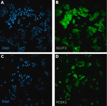 MIN6 Mouse Insulinoma Cell Line