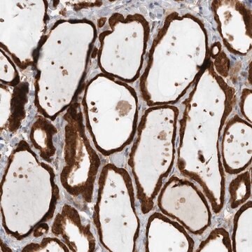 Anti-KLHL14 antibody produced in rabbit Prestige Antibodies&#174; Powered by Atlas Antibodies, affinity isolated antibody, buffered aqueous glycerol solution