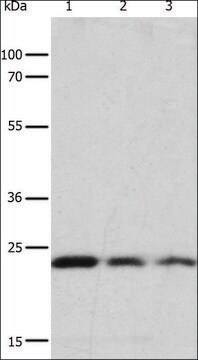 Anti-RAS antibody produced in rabbit affinity isolated antibody