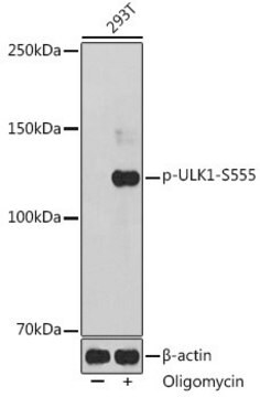 Anti-Phospho-ULK1-S555 antibody produced in rabbit