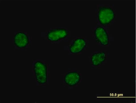 Anti-SART1 antibody produced in mouse purified immunoglobulin, buffered aqueous solution