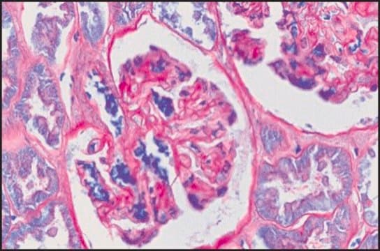 Periodic Acid-Schiff (PAS) Staining System