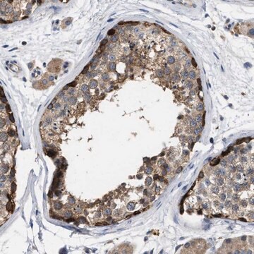 Anti-TMEM131 antibody produced in rabbit Prestige Antibodies&#174; Powered by Atlas Antibodies, affinity isolated antibody, buffered aqueous glycerol solution