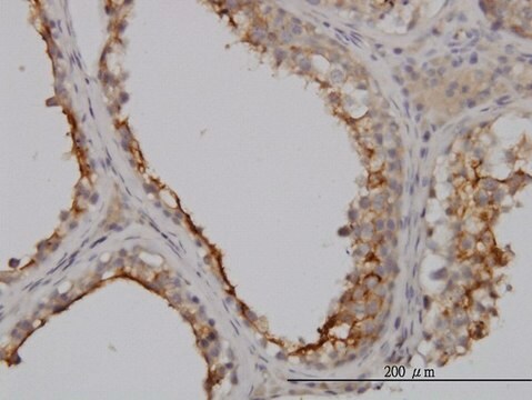 Monoclonal Anti-GGT1 antibody produced in mouse clone 1F9, purified immunoglobulin, buffered aqueous solution